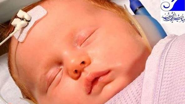 عزم نیروهای جهادی ستاد اجرایی فرمان امام برای درمان کودکان ناشنوا